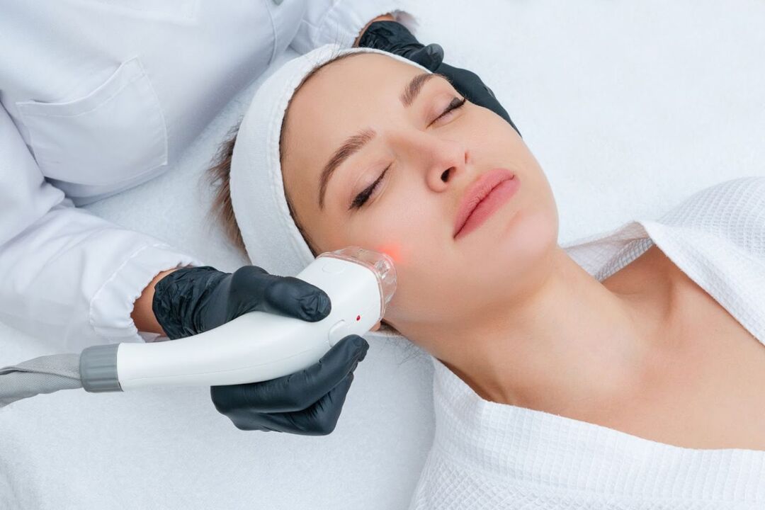 Rexuvenecemento facial con láser